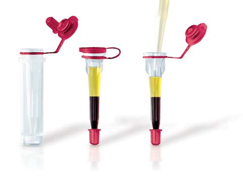 Microvette maximizing serum,plasma yield